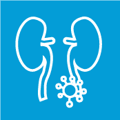 Renal Cell Carcinoma