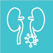 Localized Renal Cell Carcinoma