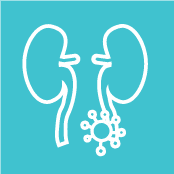 Advanced Renal Cell Carcinoma