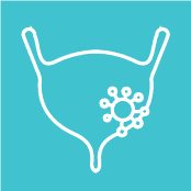 Non-Muscle Invasive Urothelial Carcinoma